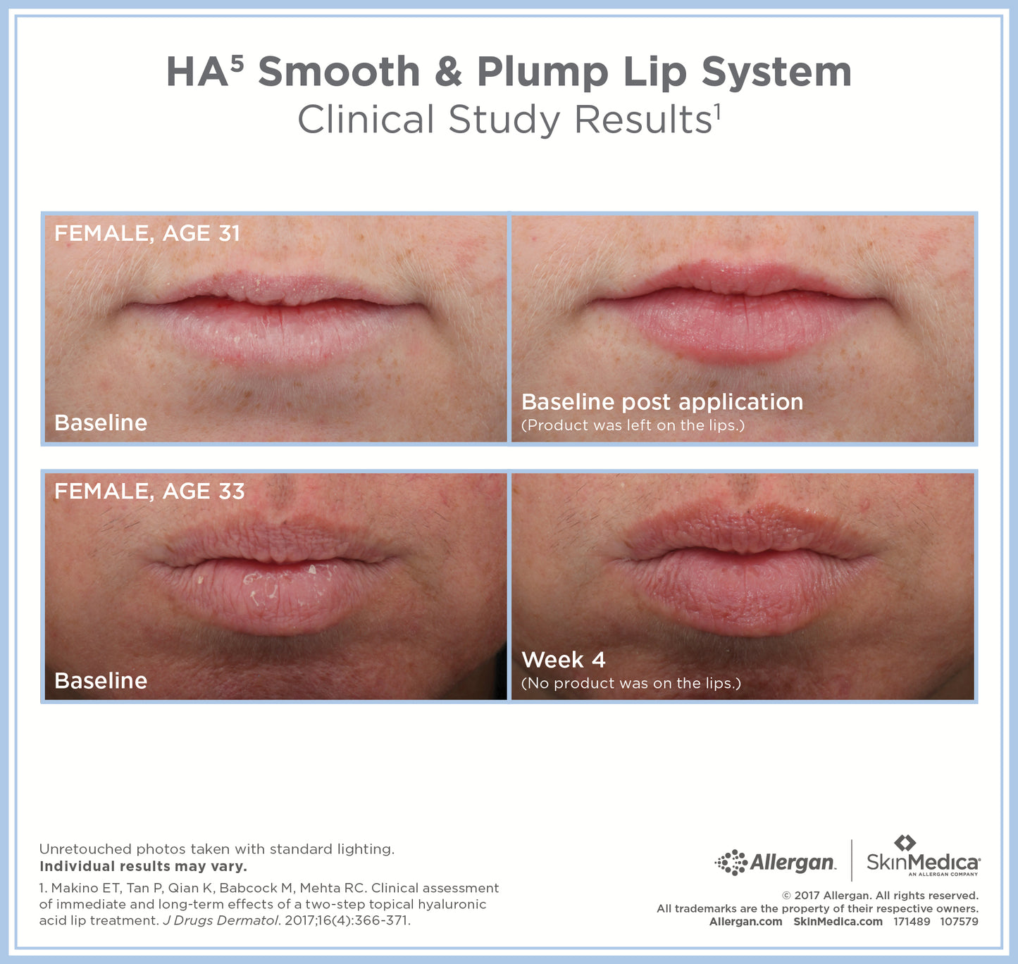 SkinMedica HA⁵® Smooth Plump Lip System