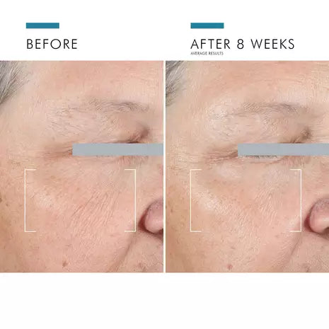 SkinCeuticals™ A.G.E Advanced EYE