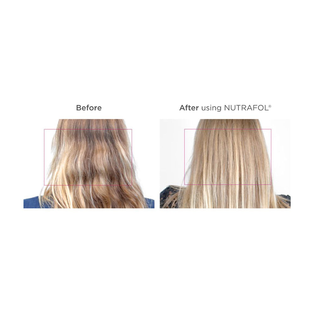 Nutrafol® Women's Hair Growth 3-Month Supply