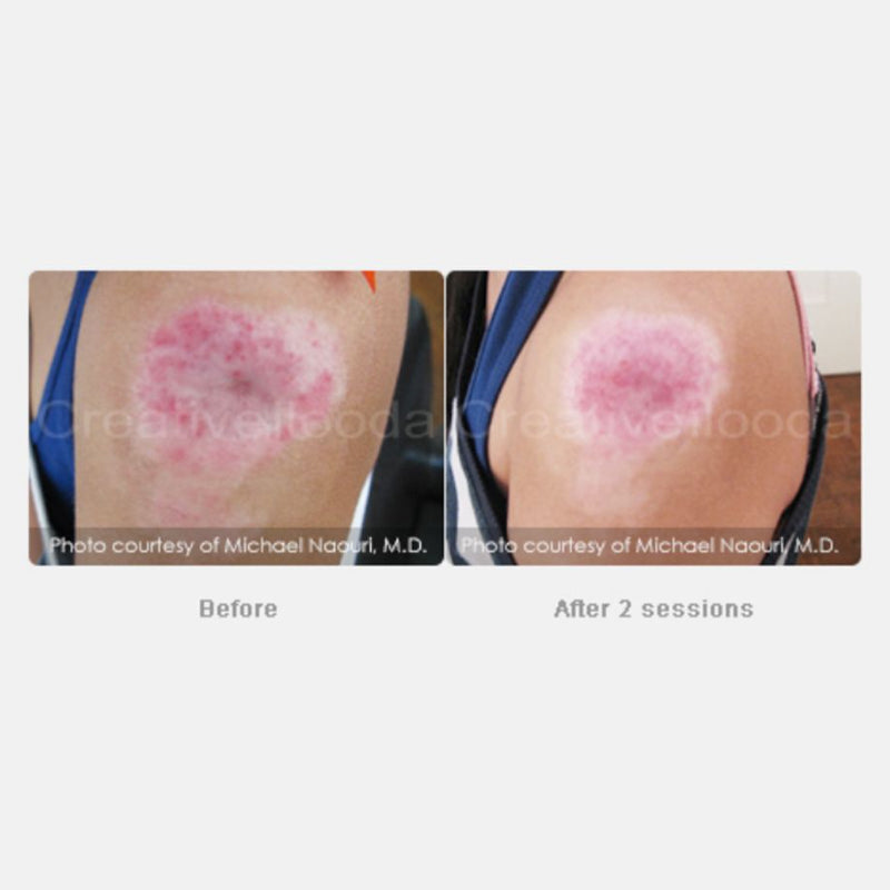 Secret RF Black Friday Special