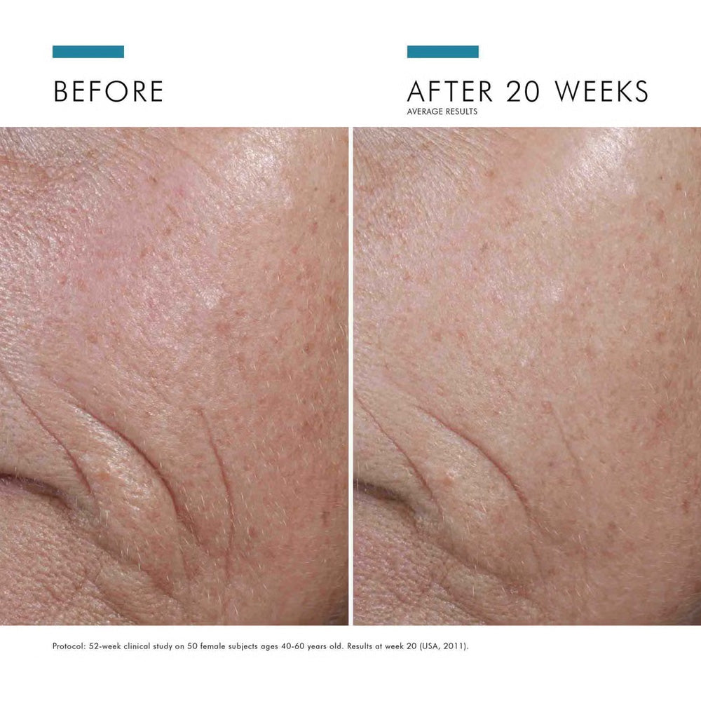 SkinCeuticals™ C E Ferulic® with 15% L-Ascorbic Acid