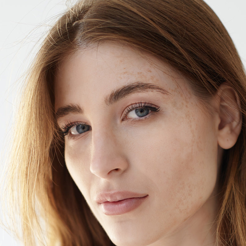 Hyperpigmentation/Uneven Skintone