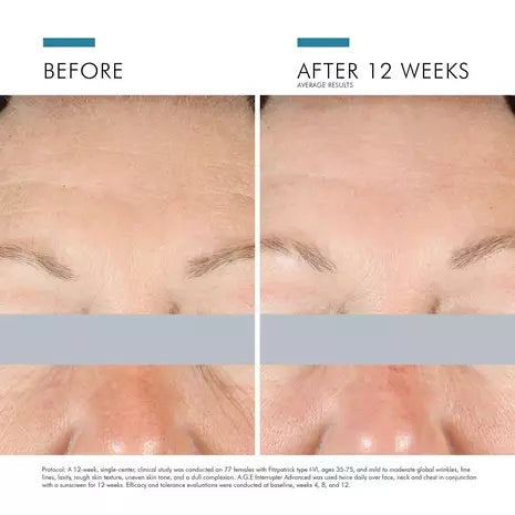 SkinCeuticals™ A.G.E Interrupter Advanced
