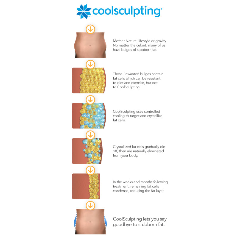 CoolSculpting®