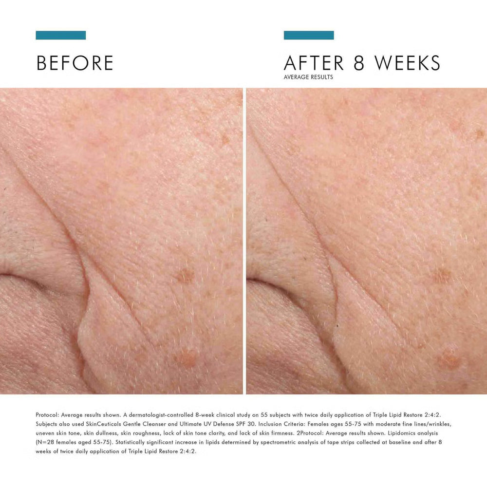 SkinCeuticals™ Triple Lipid Restore 2:4:2